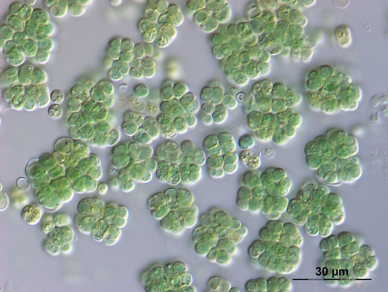 Unter dem Mikroskop werden die einzelligen Felskugeln der Art Chroococcidiopsis cubana sichtbar, die von Gallerthüllen umgeben sind. Die Gallerthüllen schützen das Cyanobakterium vor extremer Austrocknung und übermäßiger Sonneneinstrahlung. (Tatyana Darienko, Universität Göttingen (SAG-Nr. 39.79))
