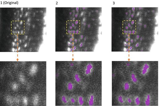 Die Anpassungsfähigkeit von EfficientBioAI wurde anhand mehrerer Anwendungen getestet. Ein Beispiel ist die semantische Segmentierung bei 3D-Aufnahmen. Dabei identifiziert das KI-Model einzelne spezifische Strukturen innerhalb eines dreidimensionalen zellulären Umfelds. Die Abbildung zeigt die Segmentierung von Osteozyten (reife Knochenzellen) in Aufnahmen von Mäuseknochen. Diese wurden mit dem Lichtblatt-Fluoreszenzmikroskop aufgenommen.Die Darstellung zeigt die Originalaufnahme (Spalte 1), die Segmentierung durch das Modell FNet 3D (Spalte 2) aus der MMV_Im2Im Toolbox für die Bild-zu-Bild-Transformation, und die Segmentierung nach der Kompression von FNet 3D durch EfficientBioAI (Spalte 3). Der Vergleich von Spalte 2 und 3 verdeutlicht: Die Kompression beeinflusst keineswegs die Genauigkeit der Segmentierung.(Bild:  ISAS / Prof. Dr. Anika Grüneboom (Bioimaging))