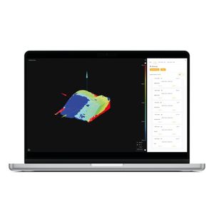 Die Halde kann nach Zeitstempel oder gemäß jeder anderen Information eingefärbt werden. So erkennt man sofort, wo sich welches Material befindet und wie viel davon vorhanden ist.(Bild:  Sachtleben Technology)