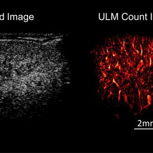 Ultraschall und Ultraschall-Lokalisations-Mikroskopie (links) einer Mausniere im Vergleich. Die neue Technik ermöglicht es, auch kleinste Gefäße sichtbar zu machen.(Bild:  Georg Schmitz)