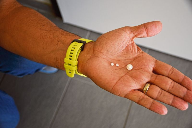 Diese Planetenträger hat Maxon in Zirkonoxid gefertigt. (Bild: Simone Käfer)