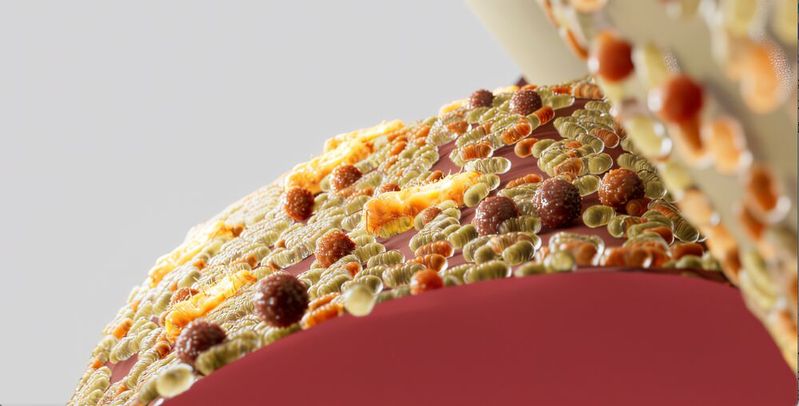 Schematische Darstellung des durch P. gingivalis veränderten Mikrobioms. Das Zahnfleisch ist zurückgegangen und gerötet.(Bild:  © PerioTrap)