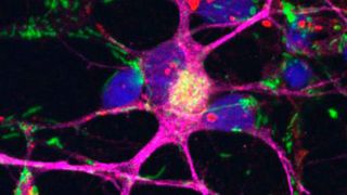 Nervenzellen (lila), die aus Stammzellen von Parkinsonpatienten entwickelt wurden. Die Zellkerne sind blau, die Mitochondrien grün gefärbt. ((c) Deleidi, 2018)