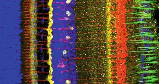 Konfokalmikroskopie-Aufnahme einer Netzhaut: Die Netzhaut (Retina), die unser Auge von innen auskleidet, ist eine fantastische „Innovation“ der Evolution. Die Zellen der Retina wandeln Licht in Nervenimpulse um.(Bild:  PC Koch, M Hess; J Neurosci Res 89:1316 (2011); doi:10.1002/jnr.22651)
