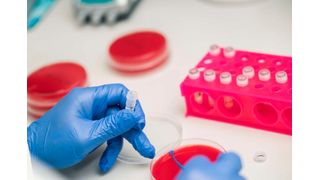 Ein Team der Veterinärmedizinischen Universität Wien hat untersucht, wie Lebensmittel das Überleben von Listerien im Verdauungstrakt beeinflussen. (Symbolbild) (Bild: Thomas Suchanek/Vetmeduni)