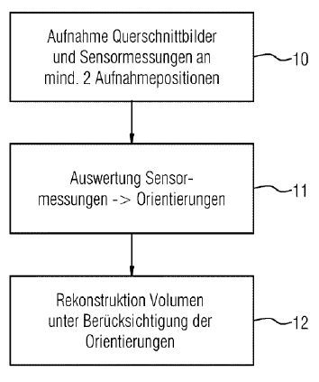 Verfahren zur intraluminalen 3D-Bildgebung und medizinisches System(Bild:  Siemens Healthineers/DPMA)