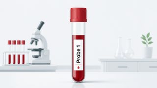 Per Blutprobe ermöglicht der NfL-Test von Roche den Nachweis von Neuroinflammation bei Multipler Sklerose – Symbolbild (Bild: GPT Image Editor / KI-generiert)