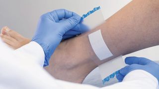 Der Träger für Wundauflagen passt sich auch an gekrümmte Oberflächen an. (Covestro)