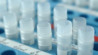 Am Helmholtz Zentrum München (HMGU) analysierten Forscher Daten zur psychischen Belastung am Arbeitsplatz sowie Konzentrationen entzündlicher Biomarker im Blut. (Bild: Helmholtz-Zentrum München)