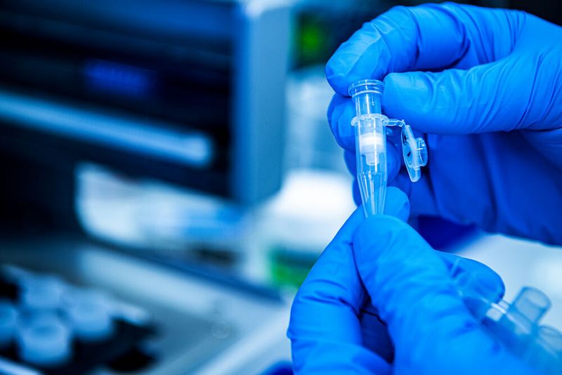 So können Forscher genetisches Material weitaus detaillierter untersuchen als zuvor. Die Entwicklung legt den Grundstein für bahnbrechende Entwicklungen in der Genomik wie Gentests und Gensequenzierung. Nominiert ist er damit für die Kategorie „Lebenswerk“. (EPA)