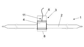 Implantat zur Behandlung von Inkontinenz (Bild: A.M.I. Agency for Medical Innovations GmbH/Universität Münster/DPMA)