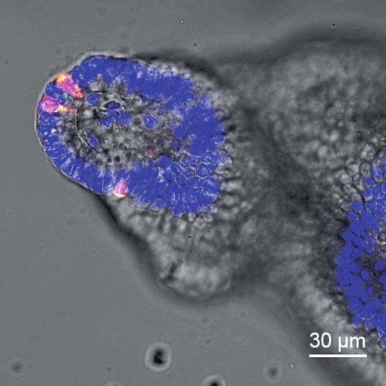 Repräsentatives immunfluoreszenzmikrosokopisches Bild von Kolon-Organoiden von Mäusen nach einer 7-tägigen Inkubation mit hitzeinaktivierten Zellen von Clostridium ramosum (Ana Mandic/DIfE)