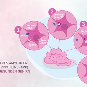 So läuft die APP-Spaltung in einem gesunden Gehirn ab. Die Spaltprodukte in der Zelle zerfallen.(Bild:  Agentur der RUB)