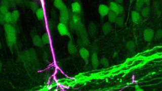 Motorische Nervenzellen im Rückenmark einer lebenden Zebrafisch-Larve. Eine Zelle mit ihrem Zellkörper und ihren Fortsätzen ist in Magenta und Weiss hervorgehoben. (Mikroskopiebild: Dempsey et al. Nature Methods 2015)