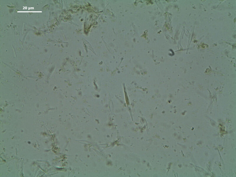 Abb.1c: Zellen der Mikroalge Phaeodactylum tricornutum nach zwei Minuten Aufschluss mit der Schwingmühle MM 400 (Bild: Retsch)
