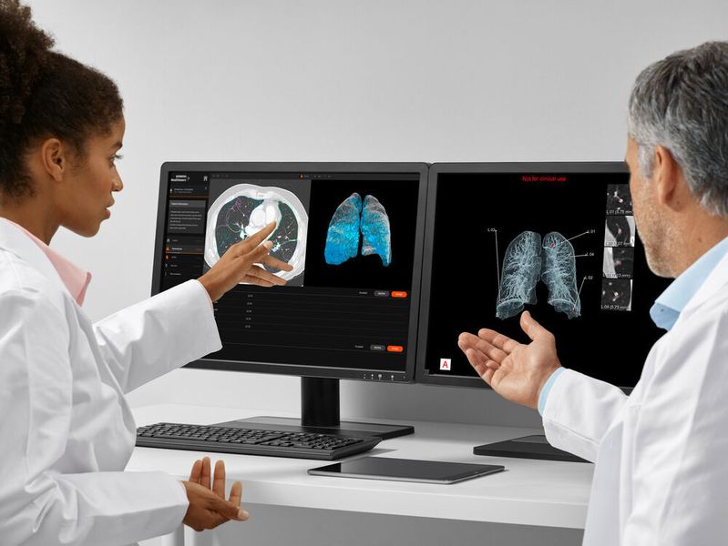 AI-Rad Companion Chest CT ist eine auf künstlicher Intelligenz (KI) basierende Software für die Computertomografie (CT). Die zugrundeliegenden Algorithmen wurden in Wissenschaftsteams bei Siemens Healthineers anhand von umfangreichen klinischen Datensätzen trainiert. (Siemens Healthineers)