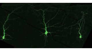 Neuronen der Großhirnrinde – die äußerste Schicht des Gehirns: Entzieht man Neuronen bestimmte Aminosäuren während der Gehirnentwicklung, hat dies schwerwiegende Folgen für Mäuse nach der Geburt. (Bild: Lisa Knaus/ISTA)