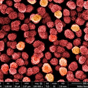 Blütenspektakel aus dem Zwergenland: Nanopartikel aus Eisen und Silber unter dem Mikroskop. Eine „Blüte“ ist rund 100 Nanometer klein.