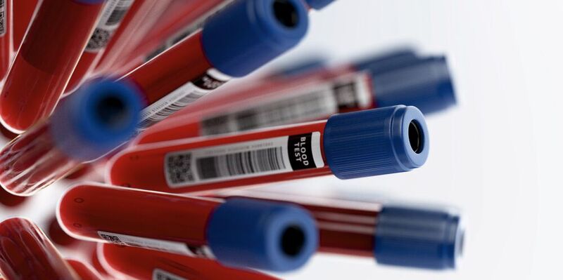 Bluttests werden für das Routine-Screening und die frühzeitige Erkennung einer Vielzahl an  Erkrankungen eingesetzt. 