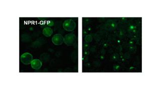NPR1 (markiert mit GFP) wandert nach der Aktivierung durch Stickoxid in die Zellkerne.  (Bild: Helmholtz Zentrum München)