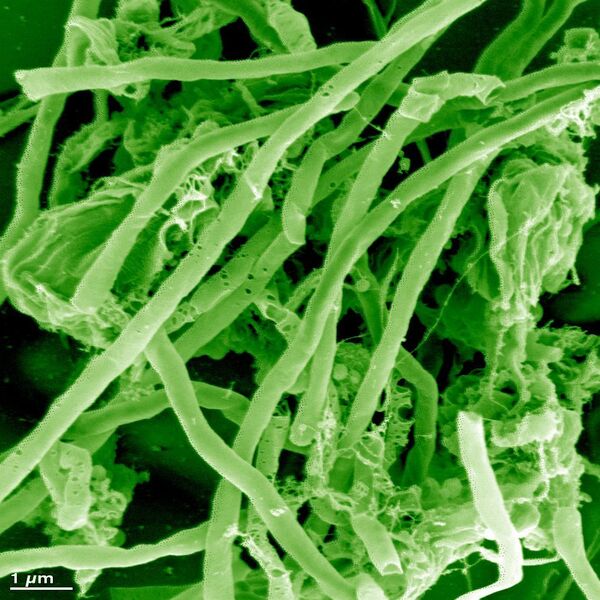 Elektronenmikroskop-Fotografie des von Electrochaea patentierten Archeen Stammes, einer Variation von Methanothermobacter thermautotrophicus (Andreas Klingl)