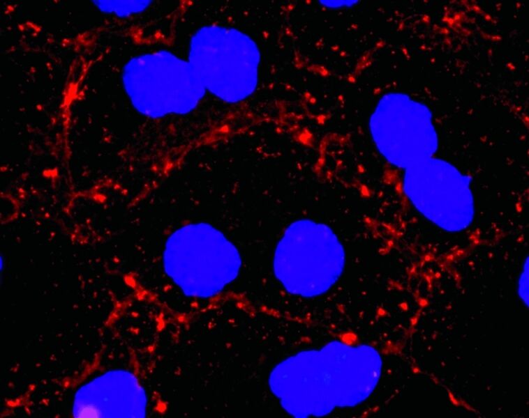 Abb. 1b Fluoreszenzmikroskopische Aufnahmen des Effektes von Chivosazol F (12, 50 ng/mL) auf die F-Actin Organisation in Hautkrebszellen des Typs A 431: 18 Stunden nach der Behandlung. F-Actin ist mit Phalloidin (rot) und die Zellkerne mit DAPI (blau) gefärbt. (Archiv: Vogel Business Media)