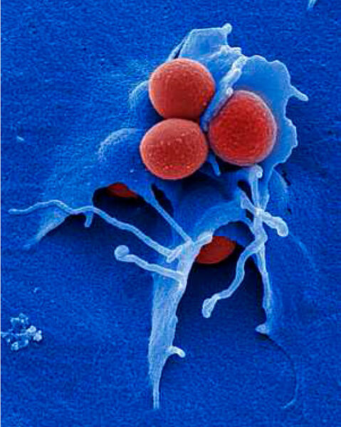 Das Bakterium Staphylococcus aureus (rot) bildet häufig Resistenzen gegen Antibiotika aus. Methicillinresistente Staphylococcus aureus-Stämme (MRSA) sind besonders für Patienten gefährlich, die bereits unter einer Infektion mit dem AIDS-Erreger HIV leiden. (© HZI/M. Rohde)