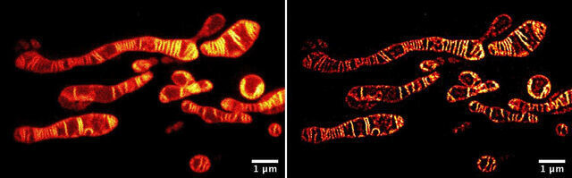 Raw (left) and sharapened (deconvolved; right) Time-gated Sted microscope images of inner membranes of live mitochondria captured at a resolution of 60 nanometers using the MitoPB Yellow fluorescent marker developed at Nagoya University. (Nagoya University)
