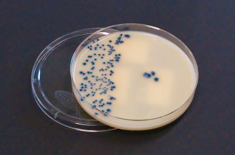 Carbapenemase-produzierende Enterobakterien (blau gefärbt) auf einer Agarplatte. (Foto: Institut für Medizinische Mikrobiologie der Justus-Liebig-Universität Gießen / Judith Schmiede)