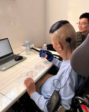 Das BCI-Implantat Neo von Neuracle wird minimal-invasiv im Hinterkopf-Bereich in den Schädelknochen eingesetzt. Die Sensoren liegen auf der harten Hirnhaut, ohne in das Hirngewebe selbst einzudringen.(Bild:  Neuracle)