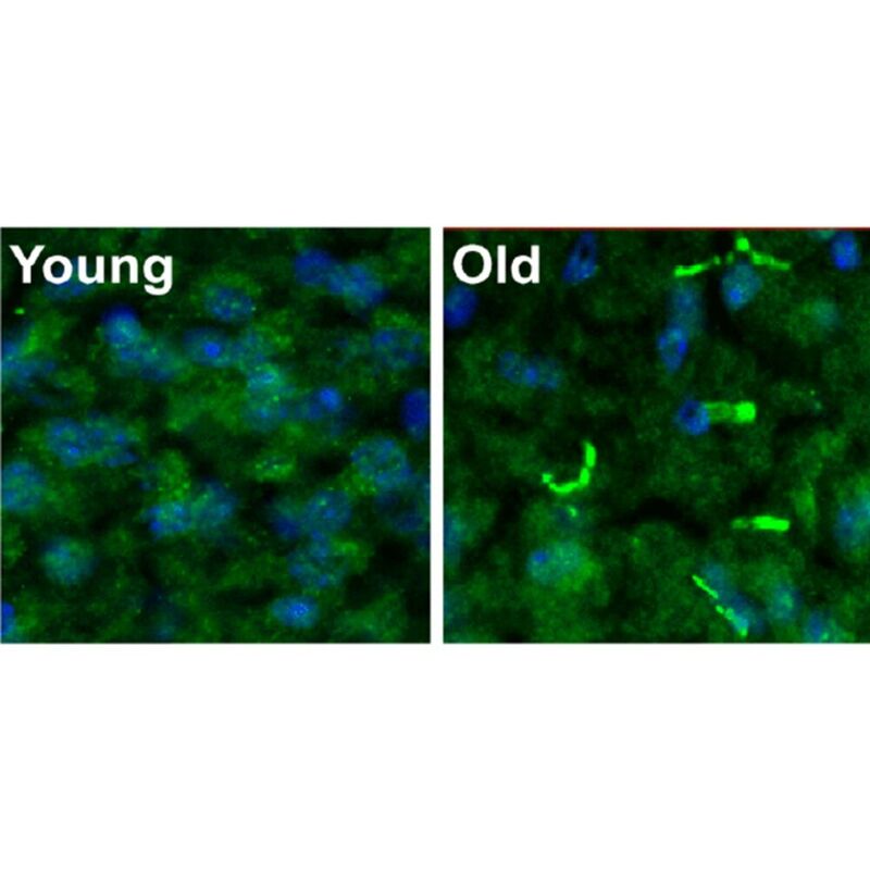 PDE11A memory enzyme (green) in the brains of young (left) and old (right) mice.