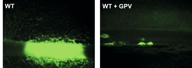 Behandlung einer Maus mit löslichem GPV verhindert die Bildung eines gefäßverschließenden Thrombus in einem experimentellen Modell zur Thrombosebildung (r.). Im Vergleich dazu ist ein gefäßverschließender Thrombus einer unbehandelten Maus gezeigt (l.).