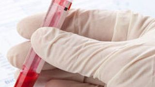 Depression ist im Blut nachweisbar (Bild: Shawn Hempel - Fotolia)