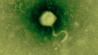 Elektronenmikroskopische Aufnahme eines Bakteriophagen. (Bild: Dinhopl/Vetmeduni Vienna)