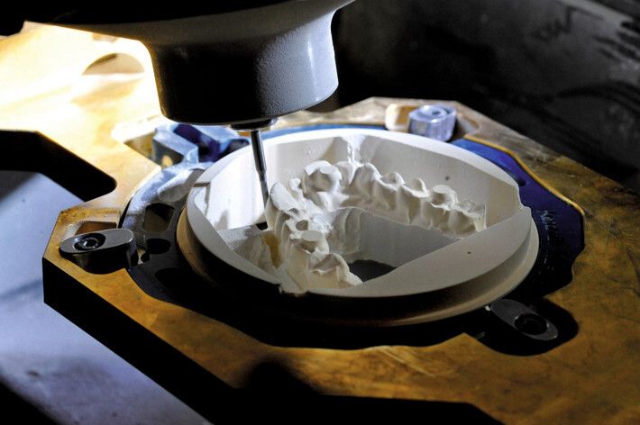 Die Zahntechnik, in der schnell individuelle Lösungen gefordert sind, profitiert vom Additive Manufacturing. (Bild: Messe Erfurt)