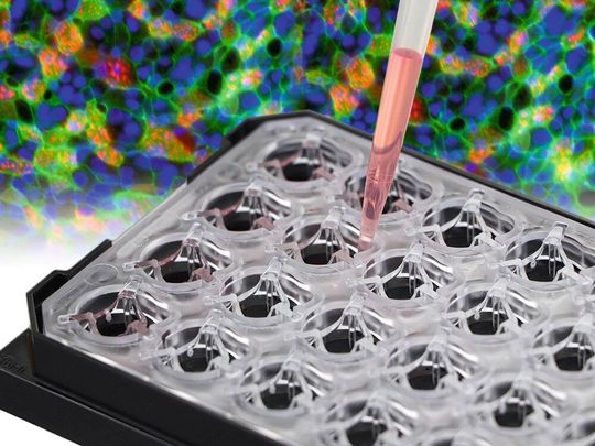 Ibidi präsentiert die neue µ-Plate 24 Well für Membran-Inserts.(Bild:  Ibidi)