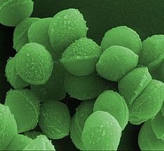 Streptococcus pyogenes ist eines der Bakterien, dessen CRISPR-Cas-System die HZI-Forscher untersucht haben. (Bild: HZI / M. Rohde)
