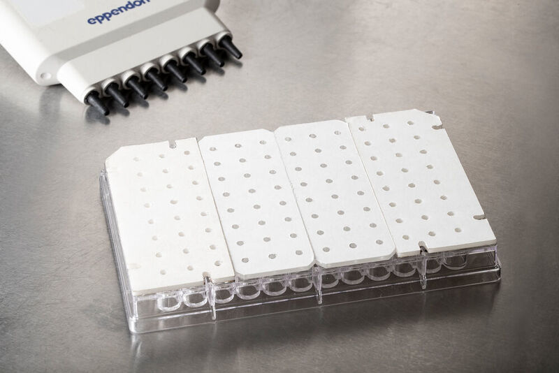 Ihre „I-Chip“-Erfindung ist ein daumengroßer Plastikchip mit winzigen Löchern, mit dem eine größere Anzahl und Vielfalt von Mikroorganismen im Labor gezüchtet werden kann. Damit wird ein langjähriges Problem in der Mikrobiologie gelöst. (EPA)