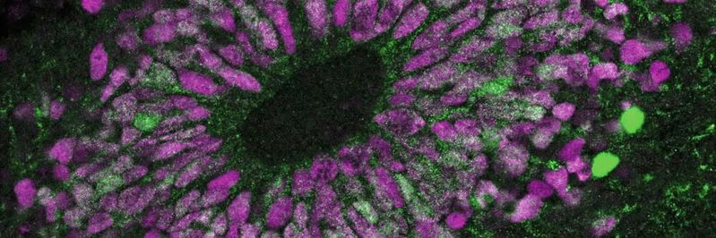 Een hersenorganoïde onder de microscoop. Neuronale stamcellen lichten magenta op. De groene kleur duidt op celactiviteit na verhoogd contact met de boodschapperstof interleukine-6.(Afbeelding: Kseniia Sarieva / HIH)