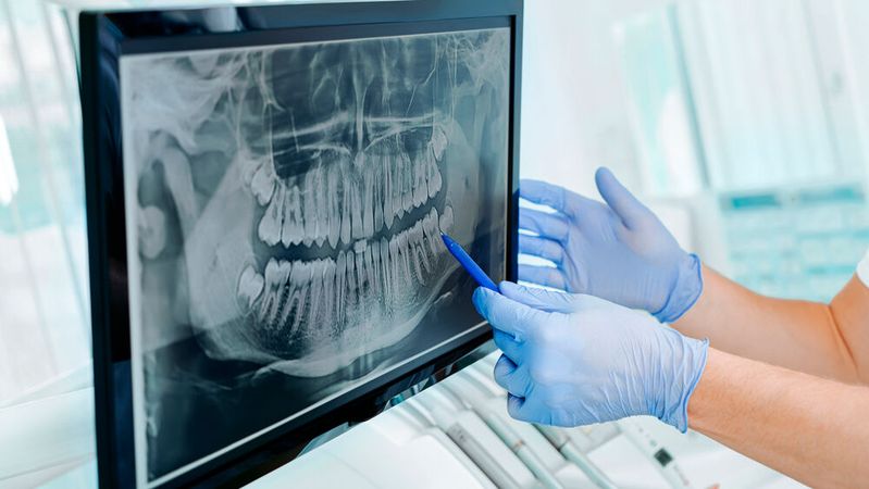Mit 8.144 geprüften Röntgenanlagen stellt die Dentalmedizin die größte Gerätegruppe.(Bild: ©  Jukov studio - stock.adobe.com)