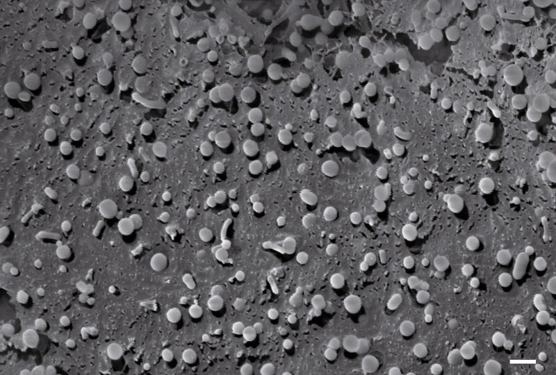 2 Kryo-SEM-Aufnahme eines Gefrierbruchs von teilweise gefriergetrockneten Liposomen; Der Grössenbalken entspricht 200 nm. (Bild: Electron Microscopy ETH Zürich – EMEZ)