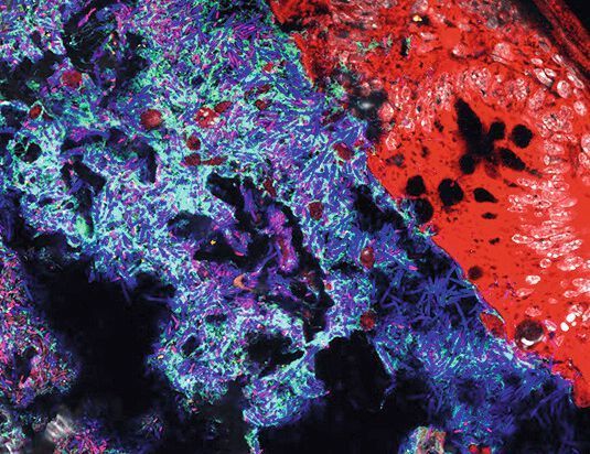 Mucispirillum (grün) und Salmonella (pink) im Darmlumen von Mäusen. Andere Bakterien sind in blau, das Darmepithel in rot dargestellt. (B. Stecher)