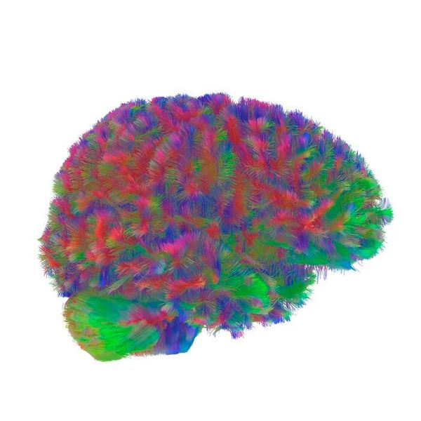 A representative MRI tractography image of the first era of the human brain. This image is representative of the general pattern seen across the brains in the study during the first era of neural wiring, between the ages of zero and nine.  (Source: Dr Alexa Mousley/ University of Cambridge)