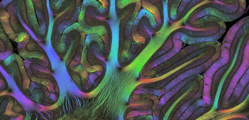 Farbenprächtige Faserbahnen  Die Aufnahme von Faserbahnen aus dem Kleinhirn eines Affen brachte dem Forscherteam um Prof. Markus Axer vom Institut für Neurowissenschaften und Medizin des Forschungszentrums Jülich den ersten Platz beim „Best Scientific Image Contest 2021“ der Helmholtz Imaging Platform (HIP). Mit seiner Mikroskopietechnik ist es möglich, die Verläufe und die Architektur von Nervenfasern in Post-mortem-Gehirnen dreidimensional in mikroskopischer Auflösung zu zeigen und zu untersuchen.  Axer nutzt eine neue Form der Polarisationsmikroskopie, die „3D Polarized Light Imaging“-Technologie (3D-PLI). Dabei durchleuchten die Forscher tiefgefrorene Hirnschnitte mit polarisiertem Licht, also Lichtwellen, die nur in einer Richtung entlang ihrer Ausbreitungsrichtung schwingen. Die Faserbahnen im Hirnschnitt ändern die Polarisation des Lichts je nach Ausrichtung der Bahn, was am Detektor erfasst und durch einen Farbkodex visualisiert wird. Eine Zweite Aufnahme desselben hirnschnitts bei leichter Neigung der Probenplatte ermöglicht später zudem, die Bilder der einzelnen Hirnschnitte zu einem 3D-Modell der Faserbahnen zusammenzusetzen, s. Video.     Hier gehts zur Originalmeldung Wissenschaftsbild des Tages vom 6.1.2022 (Forschungszentrum Jülich / Markus Axer et al.)