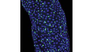 Sexualhormone steigern die Gefahr, dass onkogene Mutationen Tumoren auslösen. Das Bild zeigt Darmstammzellen mit einer krebstreibenden Mutation (grün) (Bild: Teleman/DKFZ)