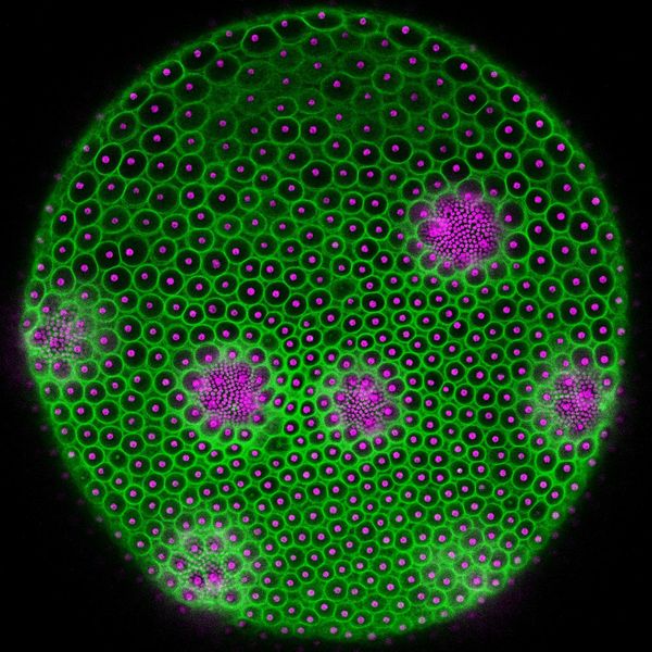 Das zelluläres Rückgrat   Wie entsteht durch das kollektive Zusammenspiel von vielen einzelnen Zellen ein perfekt geformter Organismus?  Ein internationales Team der Universität Bielefeld untersucht anhand der Grünalge Volvox carteri, wie Zellen trotz uneinheitlicher Proteinproduktion gemeinsam eine geordnete Struktur außerhalb ihrer selbst erzeugen: die extrazelluläre Matrix (ECM). Die extrazelluläre Matrix ist ein netzartiges Material, das Zellen nach außen absondern. Sie gibt Geweben Struktur, überträgt Signale und spielt eine zentrale Rolle in der Entwicklung vielzelliger Organismen, auch beim Menschen, etwa in Haut, Knorpel oder dem Gehirn.  Im Rahmen der Studie wurde das ECM-Protein Pherophorin II gentechnisch mit einem fluoreszierenden Marker versehen. Dadurch ließ sich die Feinstruktur der ECM im lebenden Organismus sichtbar machen. Die Wissenschaftler entdeckten so, dass die Zellen eine stabile äußere Struktur ohne direkte Koordination erschaffen. Die ECM-Form folgt einer k-Gamma-Verteilung, was starke Proteinvarianzen zwischen Zellen zeigt. Diese Ergebnisse liefern neue Einblicke in die Entwicklungsbiologie, denn Selbstorganisation und ein Zusammenspiel biologischer, physikalischer und mathematischer Prozesse ermöglichen komplexe Strukturen.  Auf dem Bild zu sehen ist ein Volvox-Elternsphäroid: An der gesamten Oberfläche sind viele einzelne Zellen als magentafarbene Punkte zu sehen, in wenigen größeren Gruppen mit sehr kleinen Punkten erscheinen heranwachsende Tochtersphäroide. Die grünen Bereiche zeigen die ECM-Kompartimente der einzelnen Zellen. Hier gehts zur Originalmeldung Wissenschaftsbild des Tages vom 26.08.2025  (Bild: Universität Bielefeld)