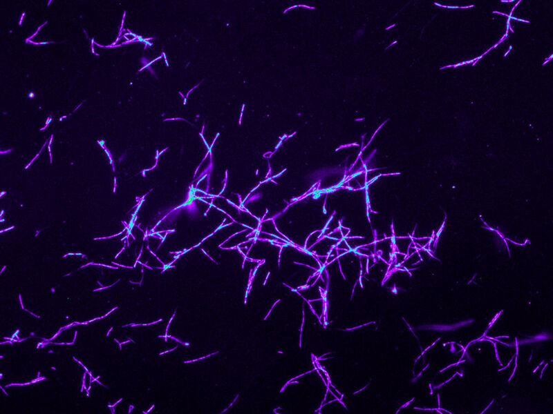 Die Fluoreszenz-in-situ-Hybridisierung (FISH) macht die Verteilung symbiotischer Bakterien (Streptomyces philanthi) im Antennensekret eines Europäischen Bienenwolf-Weibchens (Philanthus triangulum) sichtbar.  (Martin Kaltenpoth, Universität Mainz)