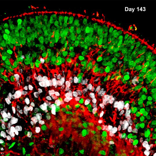 Der Querschnitt durch einen Teil eines Retina-Organoids zeigt die Zelltypen und Struktur der Netzhaut von Wirbeltieren. (Ausschnitt)(Bild:  MPI für molekulare Biomedizin / Yotam Menuchin-Lasowski)