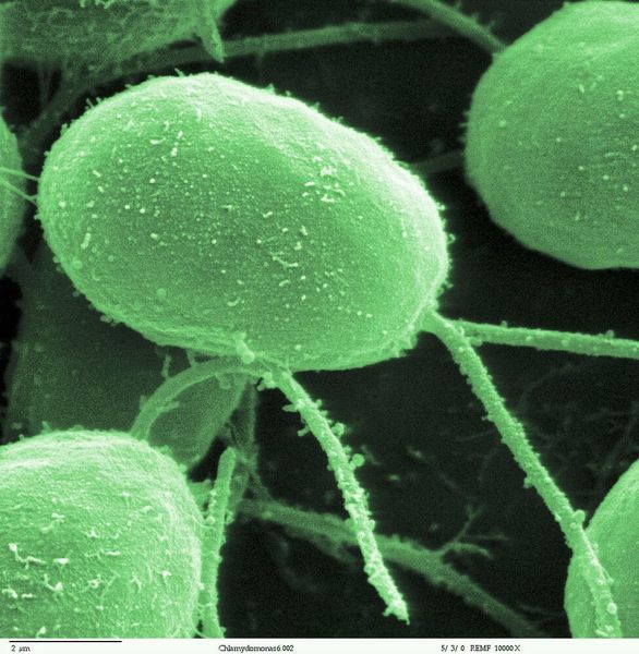 Elektronenmikroskopische Aufnahme einer Grünalge (Chlorophyta), digital eingefärbt.
Smith, E.F and P.A. Lefebvre (1996) „PF16 Encodes a Protein with Armadillo Repeats and Localizes to a Single Microtubule of the Central Apparatus in Chlamydomonas Flagella“, J. Cell Biology, 132(3): 359-370 (Dartmouth Electron Microscope Facility, Elizabeth Smith, Louisa Howard, Erin Dymek)