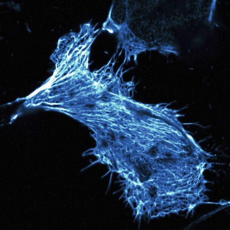 Mikroskopieaufnahme einer lebenden menschlichen Krebszelle in Zellkultur, deren Zellskelett mit fluoreszenzmarkiertem Phalloidin eingefärbt ist. Wissenschaftler schleusten diese giftige Substanz mit neu entwickelten Nanocontainern in die Zelle ein und wiesen so nach, dass die Container Stoffe, für die die Zellmembran normalerweise undurchlässig ist, in die Zelle transportieren und dort freisetzen können.